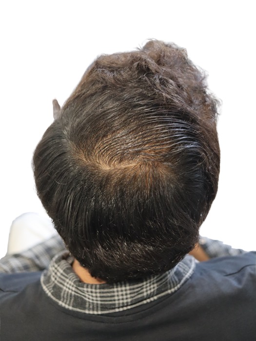 After